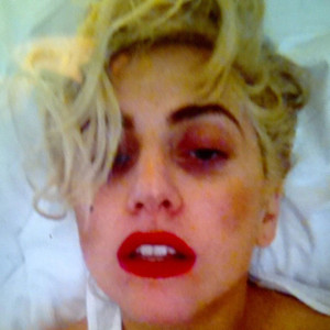 Lady Gaga Lady Gaga
